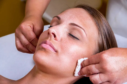 Chemical Peel facial