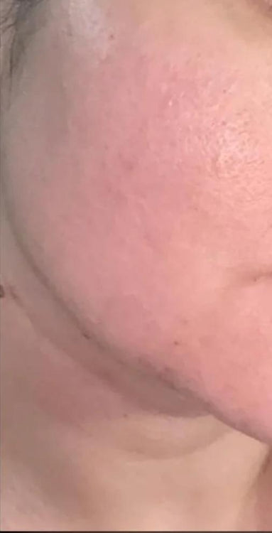 After Image