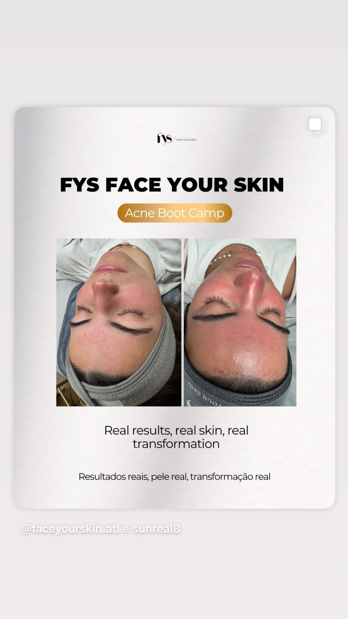 Teen Facial with Face Reality products