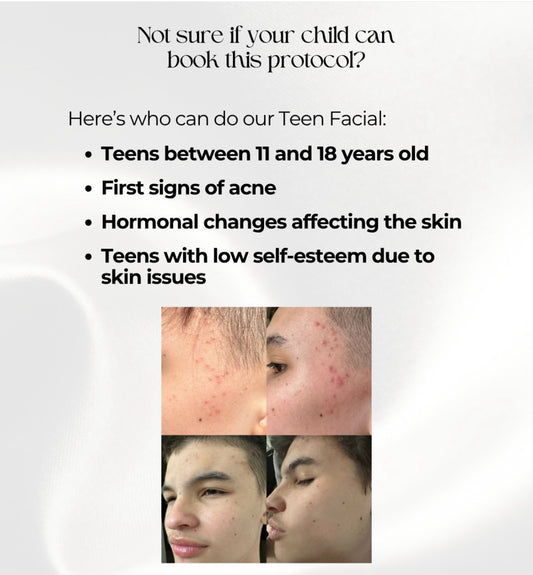 Teen Facial Package — Buy 2, Get 1 Free