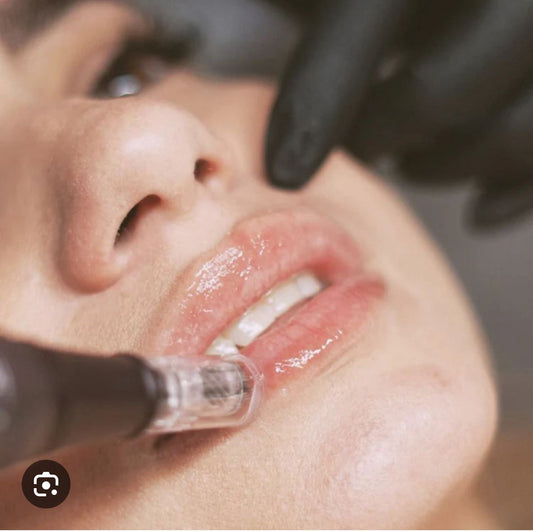 Collagen lip booster with Microneedling