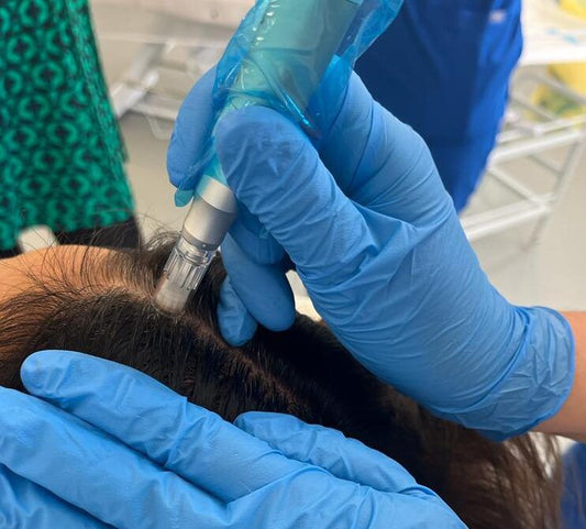 Scalp Microneedling + Red Light Therapy