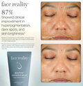 Adult Acne Facial with Face Reality (Bundle)